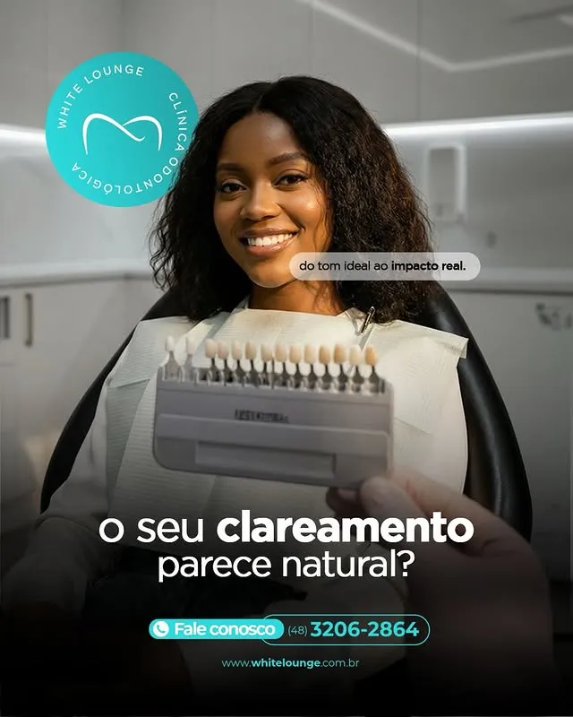 Post da White Lounge sobre clareamento dental com resultado natural